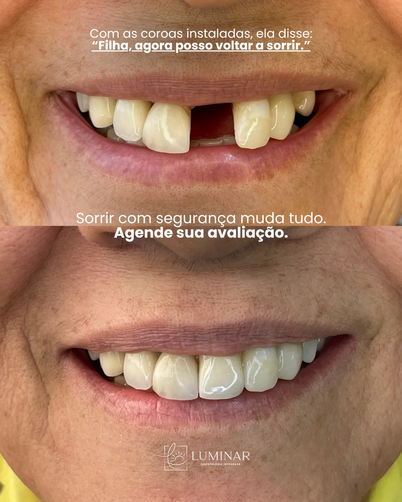 Caso clínico de antes e depois do sorriso